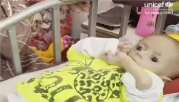 গাজায় অপুষ্টিতে কাতর শিশু, ‘কান্নাও শোনা যায় না’