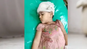 চার বছরের শিশুর সাথে এ কেমন শত্রুতা : ইট দিয়ে থেতলে দেওয়া হয়েছে মাথা