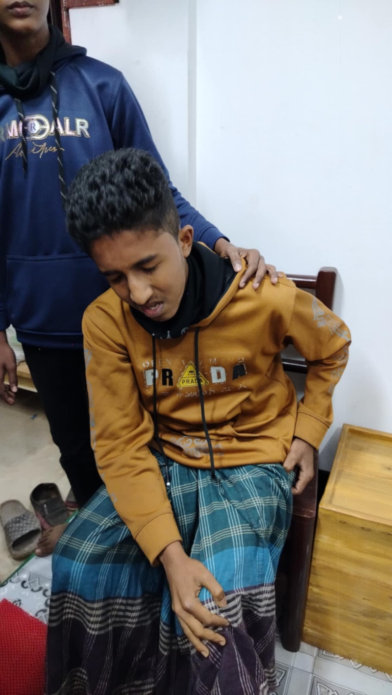 দুর্বৃত্তের ছোঁড়া রাবার বুলেটে শিক্ষার্থী আহত দুর্বৃত্তের ছোঁড়া রাবার বুলেটে শিক্ষার্থী আহত