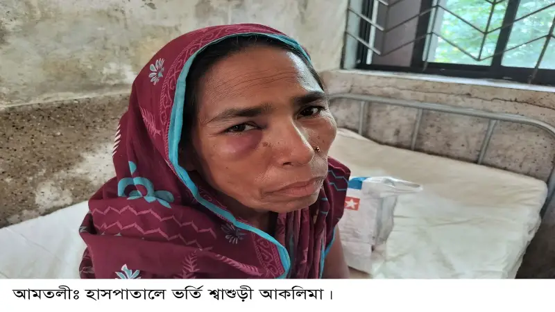 ছোট দেবরকে মোবাইল নিতে দেয়ায় শ্বাশুড়ীকে মারধর ছোট দেবরকে মোবাইল নিতে দেয়ায় শ্বাশুড়ীকে মারধর