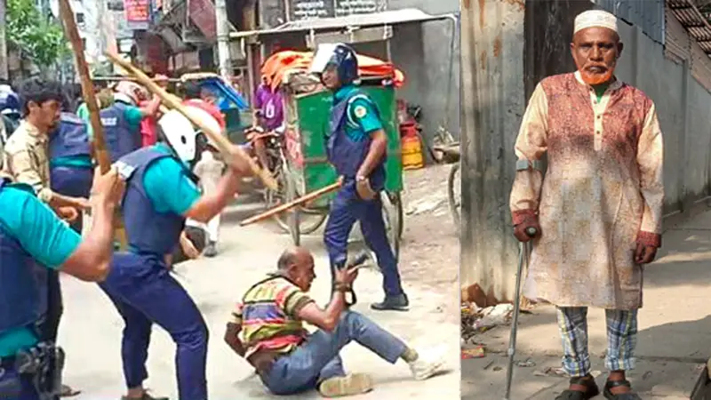 জুলাই আন্দোলনে পুলিশের লাঠিচার্জে আহত সাংবাদিক শামীম, পক্ষাঘাতগ্রস্ত হয়ে অর্থাভাবে থমকে গেছে চিকিৎসা জুলাই আন্দোলনে পুলিশের লাঠিচার্জে আহত সাংবাদিক শামীম, পক্ষাঘাতগ্রস্ত হয়ে অর্থাভাবে থমকে গেছে চিকিৎসা
