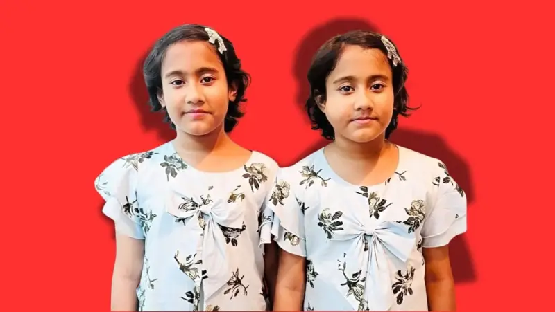 আগুনে পোড়া যমজ মেয়েদের আর্তনাদে কাঁপছে হাসপাতাল, মা-বাবার কান্নায় ভারী আকাশ