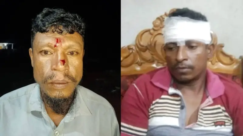 রাঙ্গুনিয়ায় বালি ব্যবসাকে কেন্দ্র করে সংর্ঘষে দুই যুবদল নেতা আহত রাঙ্গুনিয়ায় বালি ব্যবসাকে কেন্দ্র করে সংর্ঘষে দুই যুবদল নেতা আহত