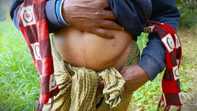 এক কিডনির গ্রাম, বাংলাদেশ-ভারতের পাচার চক্রে নিঃস্ব দরিদ্র মানুষ এক কিডনির গ্রাম, বাংলাদেশ-ভারতের পাচার চক্রে নিঃস্ব দরিদ্র মানুষ