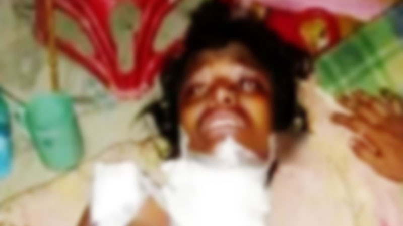 ‘মুরুব্বি মুরুব্বি উঁহু উঁহু’ বলায় শিশুর শরীর ঝলসে দিলেন নারী ‘মুরুব্বি মুরুব্বি উঁহু উঁহু’ বলায় শিশুর শরীর ঝলসে দিলেন নারী