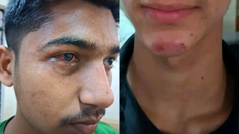 রংপুরে ছাত্রশিবিরের নেতাকর্মীদের ওপর ছাত্রদলের হামলা