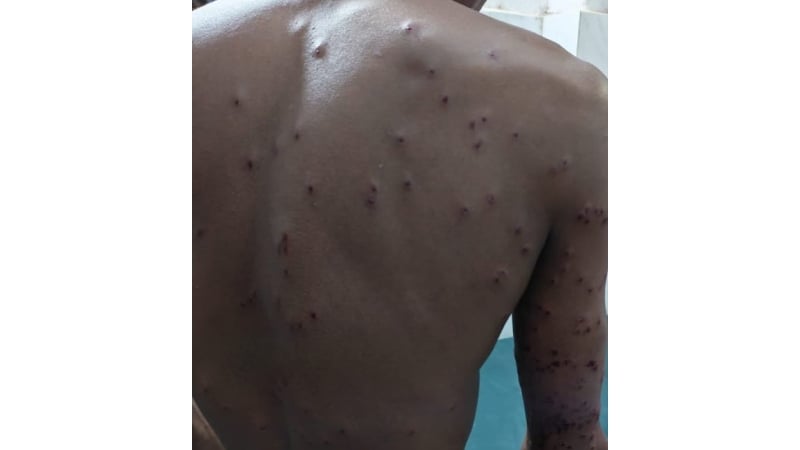 জীবননগর সীমান্তে বিএসএফের ছররা গুলিতে যুবক আহত