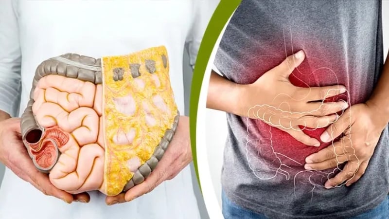 বারবার পেট ব্যথা ও ক্লান্তি? হতে পারে কোলন ক্যানসারের প্রাথমিক লক্ষণ