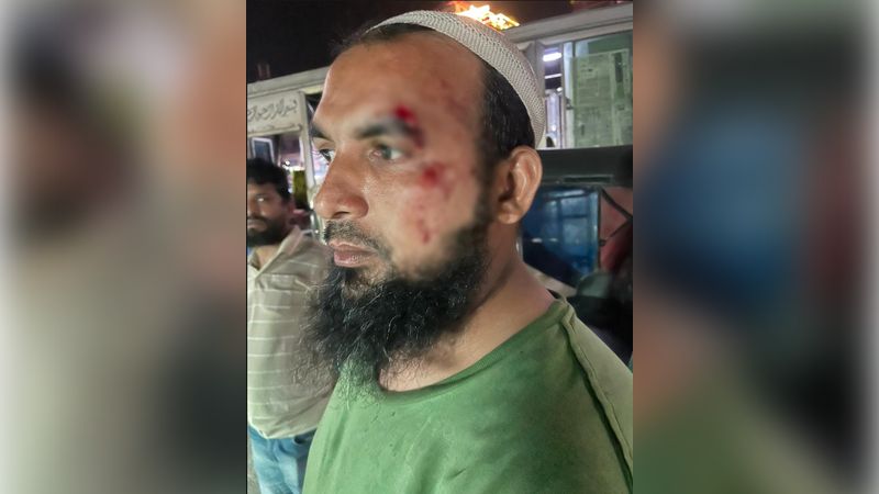 সোনারগাঁয়ে ১০০ টাকা চাঁদা না দেওয়ায় ফুটপাত ব্যবসায়ীর মাথা ফাটানোর অভিযোগ