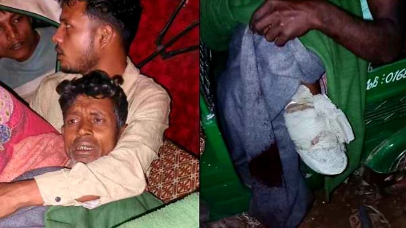 নাইক্ষ্যংছড়ি সীমান্তে স্থল মাইন বিস্ফোরণে বাংলাদেশীর পা বিচ্ছিন্ন