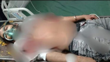 কনটেন্ট ক্রিয়েটর রাকিব আর নেই! কনটেন্ট ক্রিয়েটর রাকিব আর নেই!