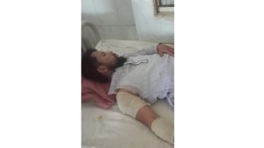 ঔষধ কোম্পানির প্রতিনিধিকে কুপিয়ে টাকার ব্যাগ ছিনিয়ে নিল দুর্বৃত্তরা ঔষধ কোম্পানির প্রতিনিধিকে কুপিয়ে টাকার ব্যাগ ছিনিয়ে নিল দুর্বৃত্তরা