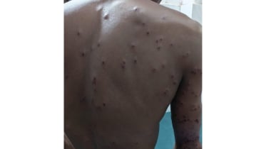 জীবননগর সীমান্তে বিএসএফের ছররা গুলিতে যুবক আহত