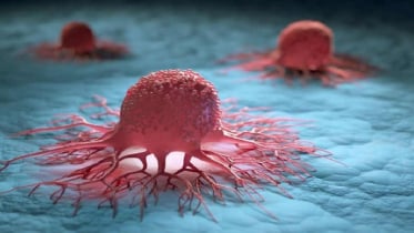 শরীরে ক্যানসারের বিষ ছড়াতে পারে এই অভ্যাসগুলো! 