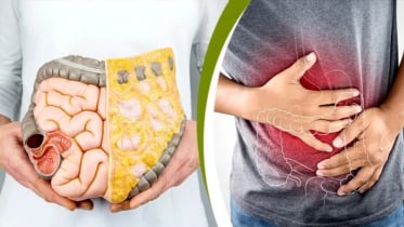 বারবার পেট ব্যথা ও ক্লান্তি? হতে পারে কোলন ক্যানসারের প্রাথমিক লক্ষণ