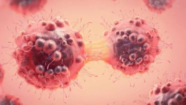 ক্যানসার ধরা পড়ে দেরিতে! শুরুতে শরীরের কোন অঙ্গে দেয় সংকেত