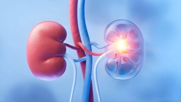 নীরব মহামারিতে রূপ নিচ্ছে কিডনি রোগ